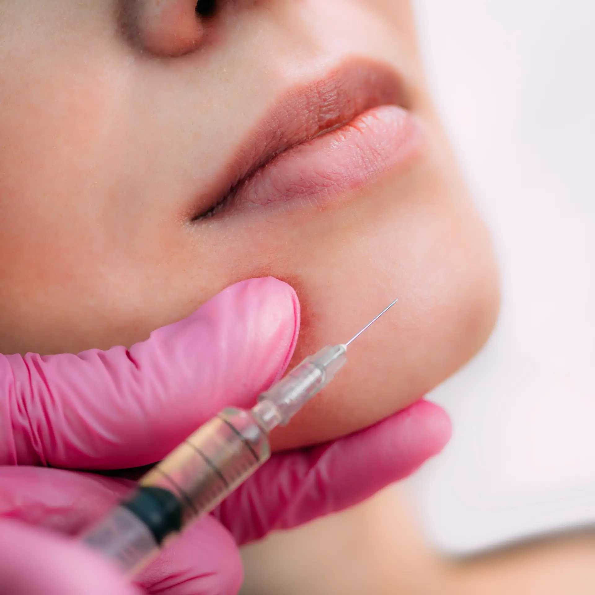 Dermal Filler Injection. A beautiful woman receives dermal filler injections for the chin.